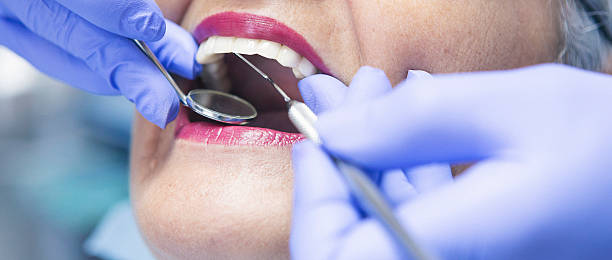 Best Knocked-Out Tooth (Avulsed Tooth) Treatment in Providence, KY